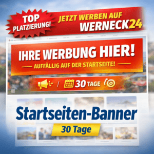 Startseiten‑Banner – 30 Tage